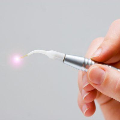 Anti-inflammatory laser therapy