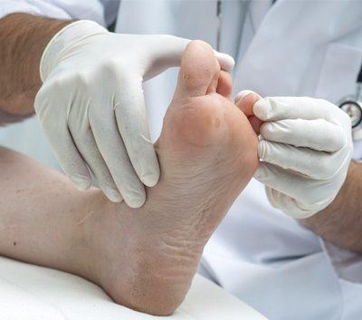 Definitive treatment of the ingrown toenail