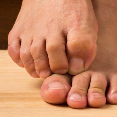 Definitive treatment of the ingrown toenail